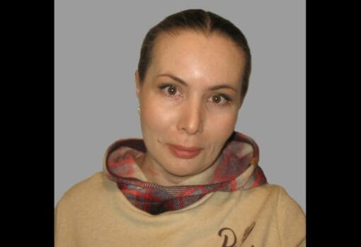 Гололвина